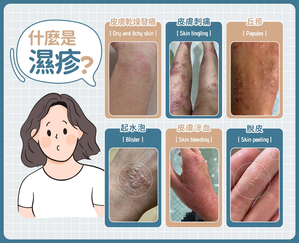 皮膚不是單獨壞掉，而是身體在替內臟「說話」